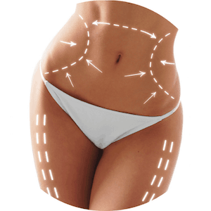 Dr-Antonio-Mere-Cirujano-Plastico-Cirugia-Plastica-y-Estetica-Abdominoplastia-en-Guadalajara_Queretaro_v001