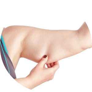 Dr-Antonio-Mere-Cirujano-Plastico-Cirugia-Plastica-y-Estetica-Braquioplastia-en-Guadalajara_Queretaro_v001-compressor