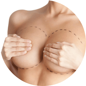 Dr-Antonio-Mere-Cirujano-Plastico-Cirugia-Plastica-y-Estetica-Mamoplastia-Implantes-Mamarios-en-Guadalajara_Queretaro_v001-compressor